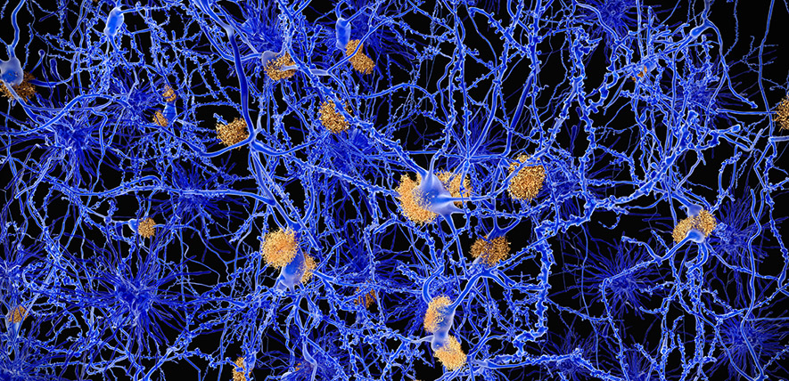You are currently viewing AI-driven techniques reveal new targets for drug discovery