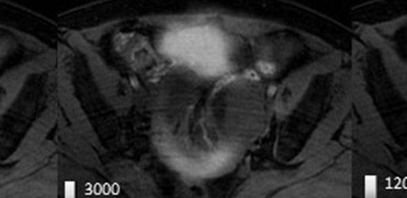 You are currently viewing Imaging technique allows rapid assessment of ovarian cancer subtypes and their response to treatment