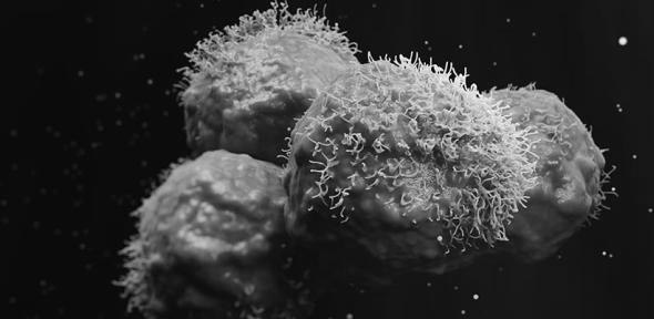 You are currently viewing Cambridge researchers develop urine test for early detection of lung cancer