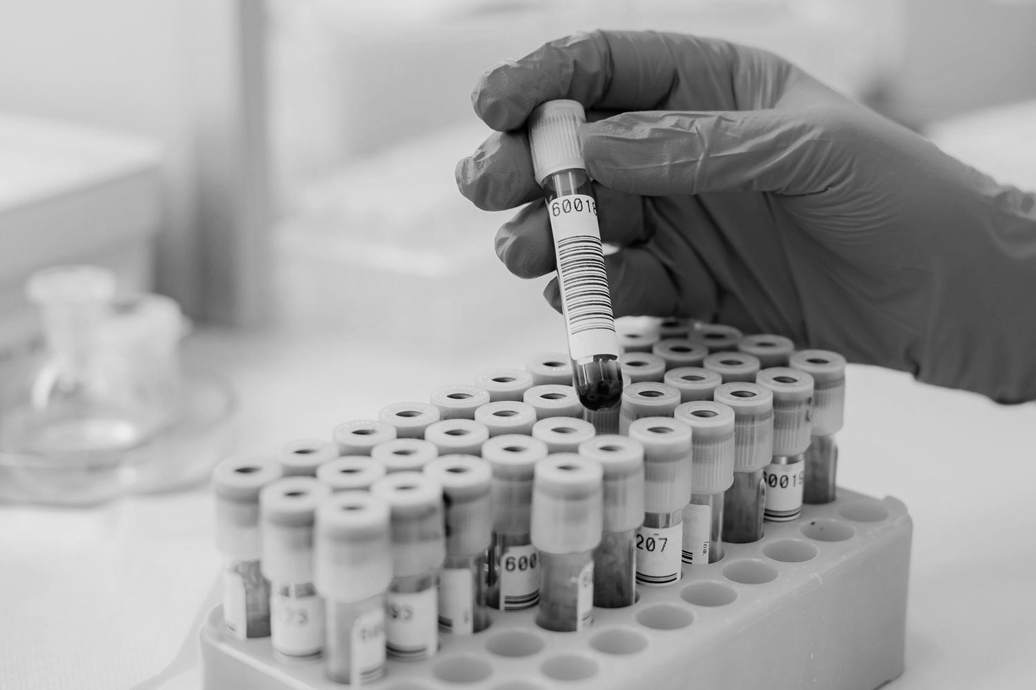 You are currently viewing Stanford Medicine offers safer, faster way to diagnose invasive mold disease