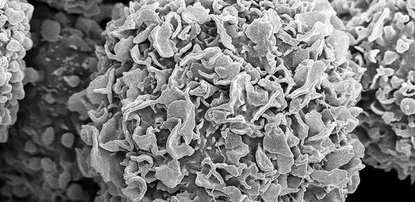 You are currently viewing ‘AI scientist’ suggests combinations of widely available non-cancer drugs can kill cancer cells