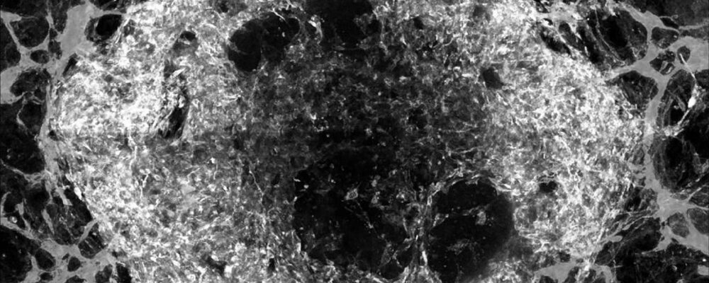 Scientists create vascularized mini-organs, advancing regenerative medicine
