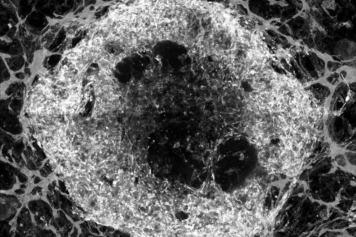 You are currently viewing Scientists create vascularized mini-organs, advancing regenerative medicine