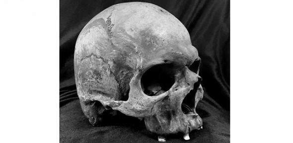 You are currently viewing Large-scale DNA study maps 37,000 years of human disease history