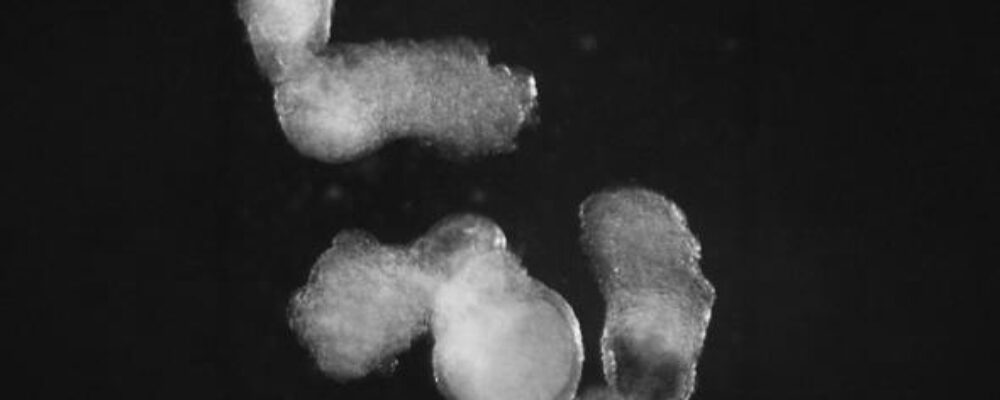 New lab-grown human embryo model produces blood cells