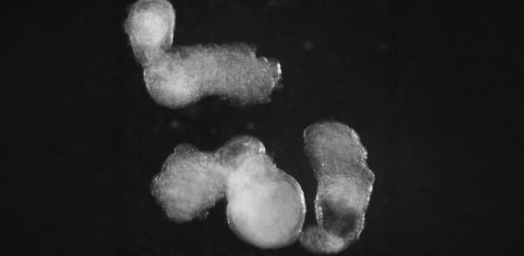 You are currently viewing New lab-grown human embryo model produces blood cells