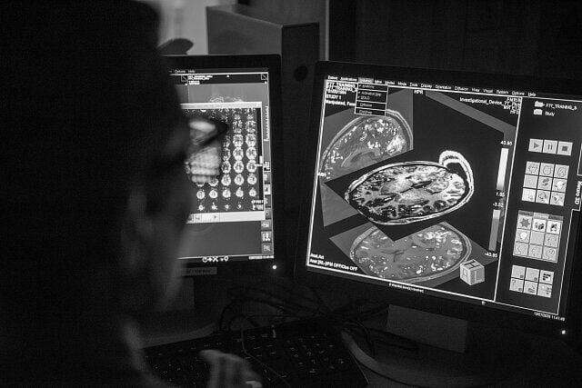 Oxford researcher reviewing an fMRI scan