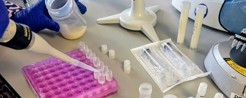Scientists study breast milk as an early detection tool for breast cancer